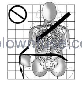 2023-Cadillac-LYRIQ-Seat-Belts-Owners-Manual-FIG6